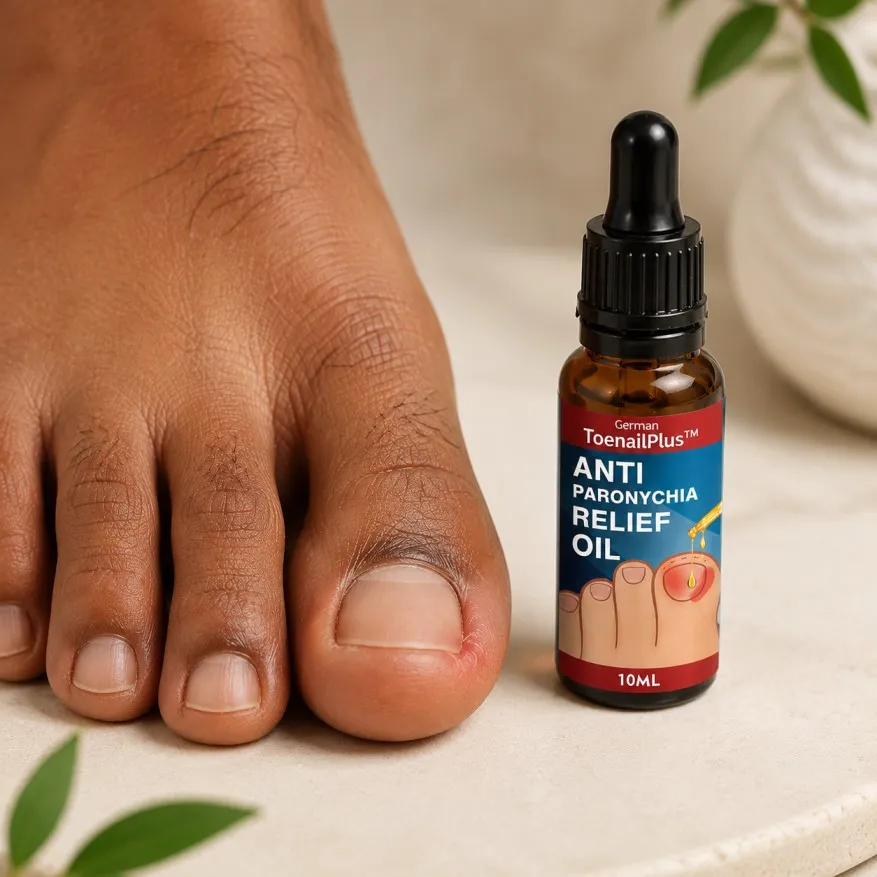Paronychia Nail Care Oil | নখের কুনির সমাধান - Image 2